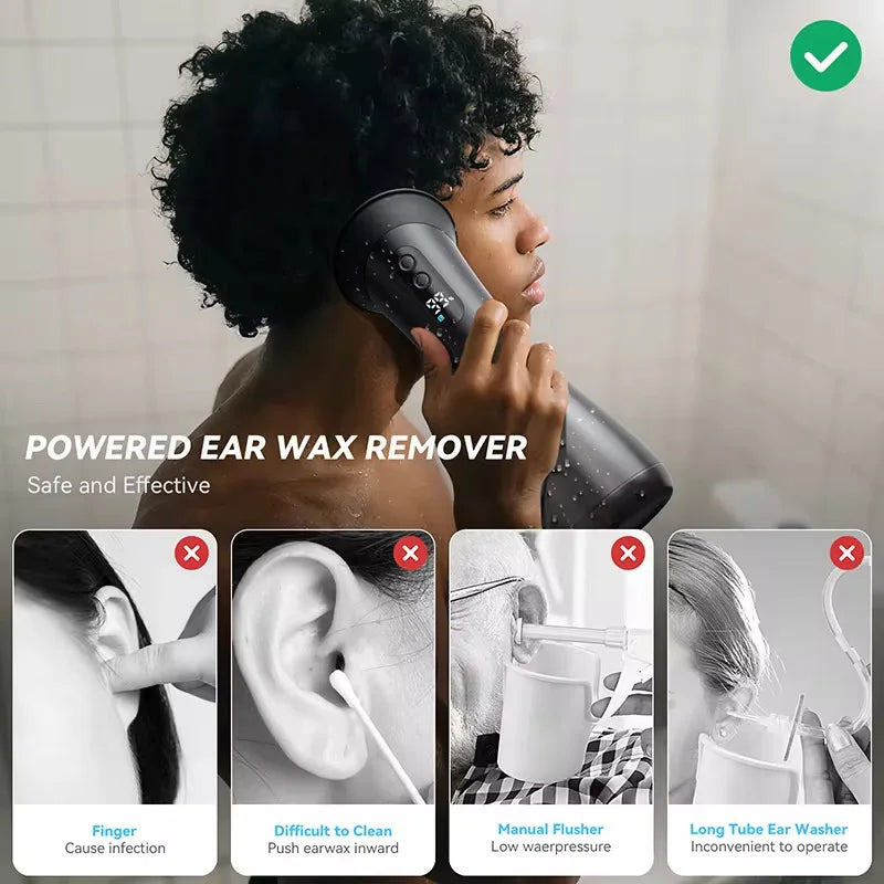Electric Ear Wax Removal System Water Powered Ear Cleaning Tool with Irrigation Flusher 3 Pressure Settings Safe & Effective Dropshipman